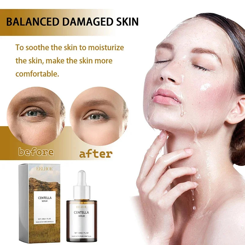 Centella Asiatica Face Serum Nourish Dry Skin Smoothing Rejuvenation Skin Brightening Whitening Cream Facial Moisturizer Korean